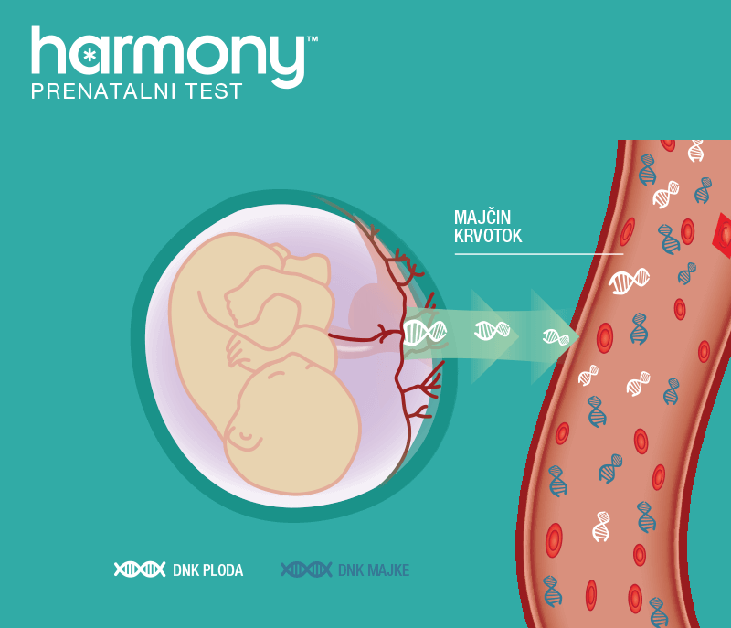 Probirnim krvnim testom Harmony otkrivaju se trisomija 21 (Downov sindrom), trisomija 18 i trisomija 13